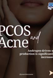 PCOS and Acne